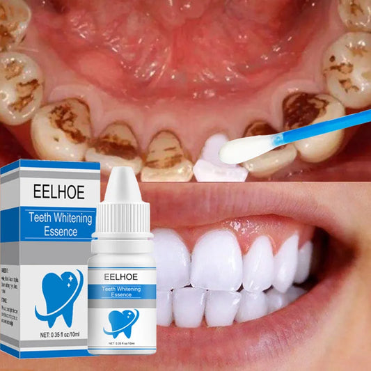 Tooth Whitening Removes Plaque Stains Tooth Bleaching Cleaning Whitening Anti-Cavity Whitening Oral Hygiene Tooth Whitening